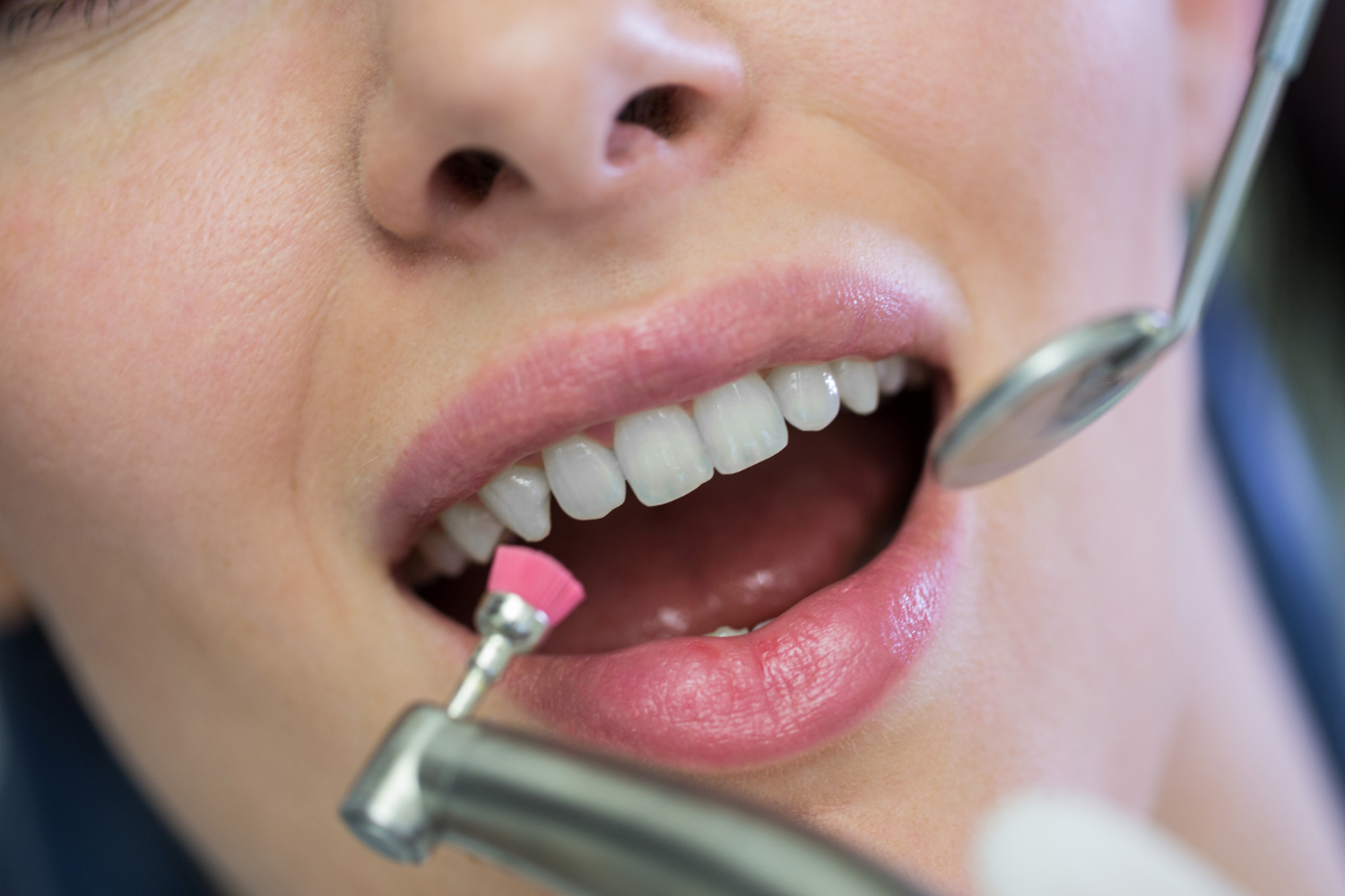 Routine Dental Care & Cleanings