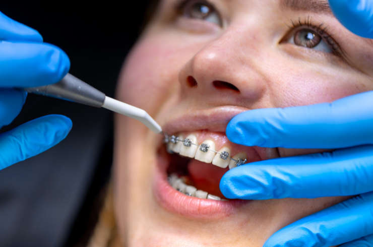 Orthodontic Treatments